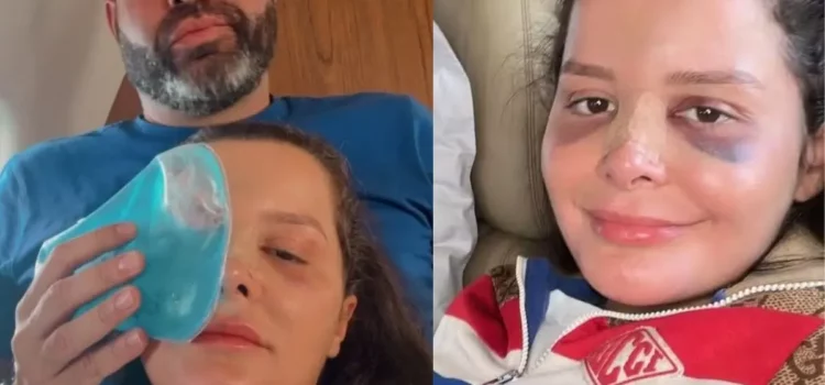 Maraisa passa por cirurgia no nariz após acidente em jacuzi de hotel em Alagoas
