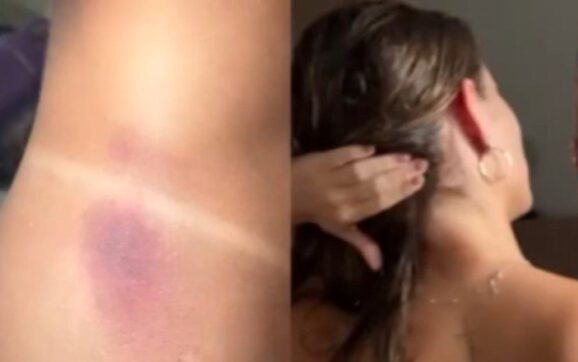 Influenciadora e sobrinha de ex-prefeito denuncia companheiro por agressão; assista